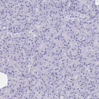 Immunohistochemical staining of human pancreas shows no cytoplasmic positivity in exocrine glandular cells as expected.