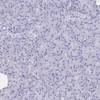Immunohistochemical staining of human pancreas shows no cytoplasmic positivity in exocrine glandular cells as expected.