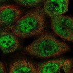 Immunofluorescent staining of human cell line A-431 shows localization to nucleoplasm & cytosol.