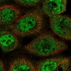 Immunofluorescent staining of human cell line A-431 shows localization to nucleoplasm & cytosol.
