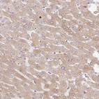 Anti-APCS Antibody
