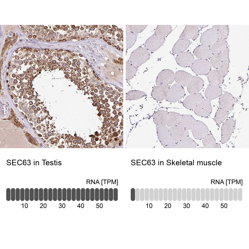Anti-SEC63 Antibody
