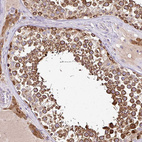 Immunohistochemical staining of human testis shows strong granular cytoplasmic positivity in cells in seminiferous ducts.