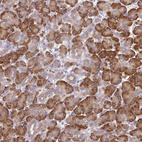 Immunohistochemical staining of human pancreas shows moderate cytoplasmic positivity in exocrine glandular cells.