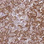 Immunohistochemical staining of human pancreas shows moderate cytoplasmic positivity in exocrine glandular cells.