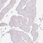 Immunohistochemical staining of human skeletal muscle shows no positivity in myocytes as expected.