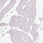 Immunohistochemical staining of human skeletal muscle shows no positivity in myocytes as expected.