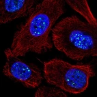 Anti-RASL11A Antibody