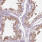 Immunohistochemical staining of human testis shows moderate cytoplasmic positivity in cells in seminiferous ducts.