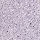Immunohistochemical staining of human liver shows no positivity in hepatocytes as expected.