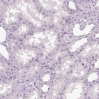 Immunohistochemical staining of human kidney shows no positivity in cells in tubules as expected.