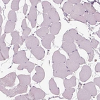 Immunohistochemical staining of human skeletal muscle shows no positivity in myocytes as expected.