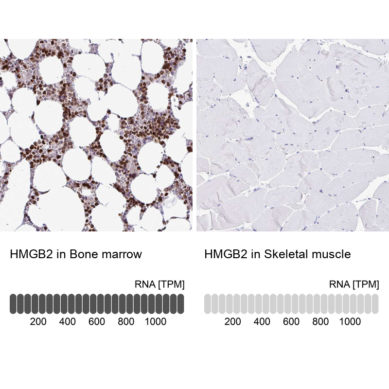 Anti-HMGB2 Antibody