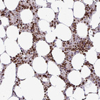 Immunohistochemical staining of human bone marrow shows strong nuclear positivity in hematopoietic cells.