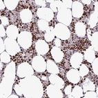 Immunohistochemical staining of human bone marrow shows strong nuclear positivity in hematopoietic cells.