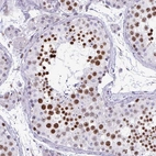 Immunohistochemical staining of human testis shows strong nuclear positivity in cells in seminiferous ducts.
