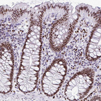 Immunohistochemical staining of human colon shows strong nuclear positivity in glandular cells.
