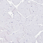 Immunohistochemical staining of human skeletal muscle shows no positivity in myocytes as expected.