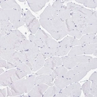 Immunohistochemical staining of human skeletal muscle shows no positivity in myocytes as expected.