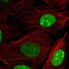Immunofluorescent staining of human cell line U-2 OS shows localization to nucleus & nucleoli.