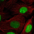 Immunofluorescent staining of human cell line U-2 OS shows localization to nucleus & nucleoli.