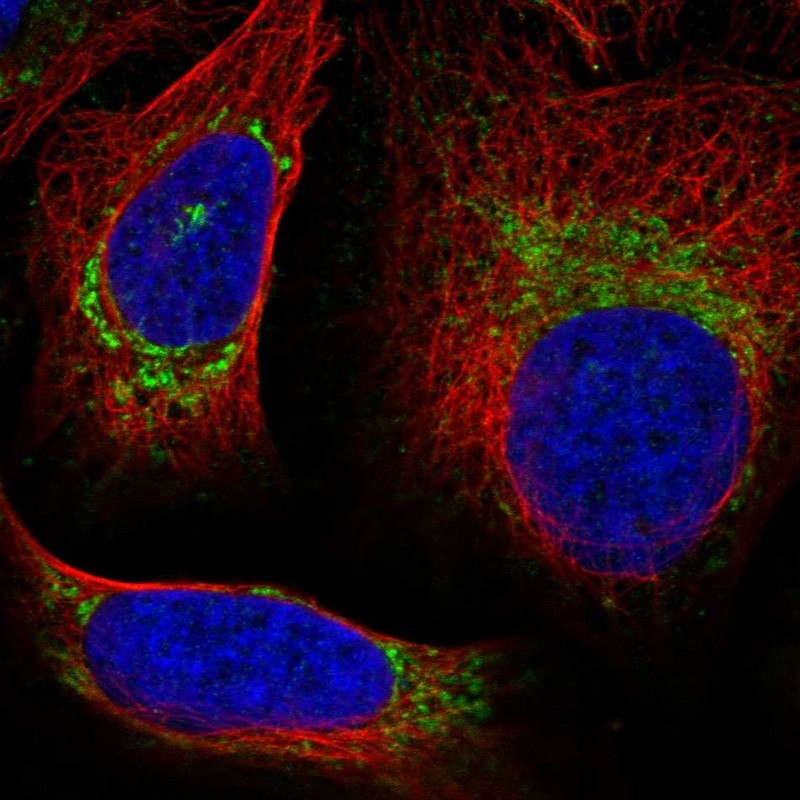Anti-UQCRQ Antibody