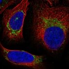 Anti-UQCRQ Antibody