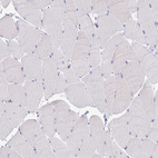 Immunohistochemical staining of human skeletal muscle shows no positivity in myocytes as expected.