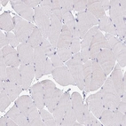 Immunohistochemical staining of human skeletal muscle shows no positivity in myocytes as expected.