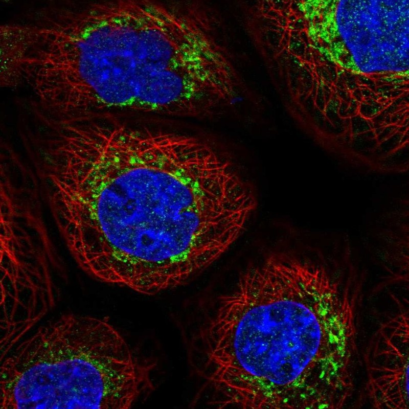 Anti-NDUFB6 Antibody