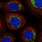 Anti-NDUFB6 Antibody