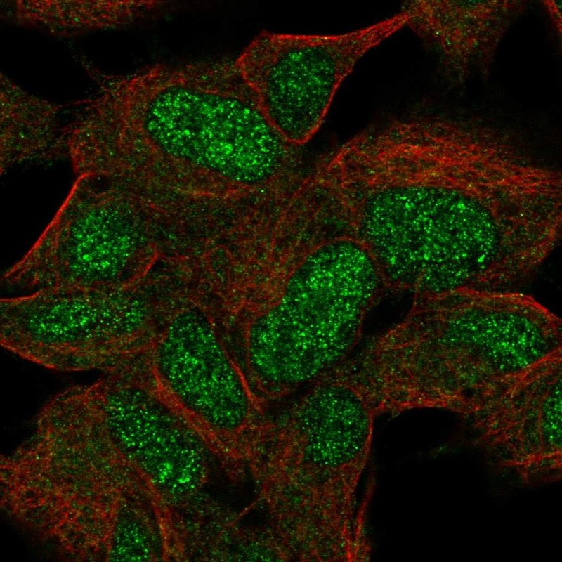 Anti-KIAA0408 Antibody