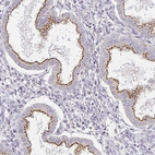 Immunohistochemical staining of human Endometrium shows strong membranous positivity in glandular cells.