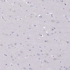 Immunohistochemical staining of human Cerebral cortex shows very weak membranous positivity in neuronal cells.