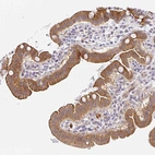 Immunohistochemical staining of human Small intestine shows strong membranous and cytoplasmic positivity in glandular cells.