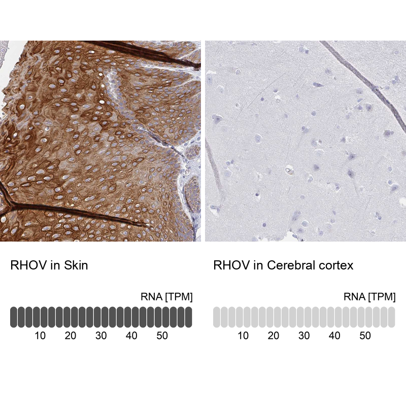 Anti-RHOV Antibody