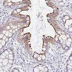 Immunohistochemical staining of human rectum shows strong positivity in apical membrane in glandular cells.