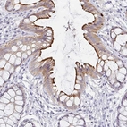 Immunohistochemical staining of human rectum shows strong positivity in apical membrane in glandular cells.
