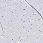Immunohistochemical staining of human cerebral cortex shows no positivity in neurons as expected.