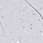 Immunohistochemical staining of human cerebral cortex shows no positivity in neurons as expected.