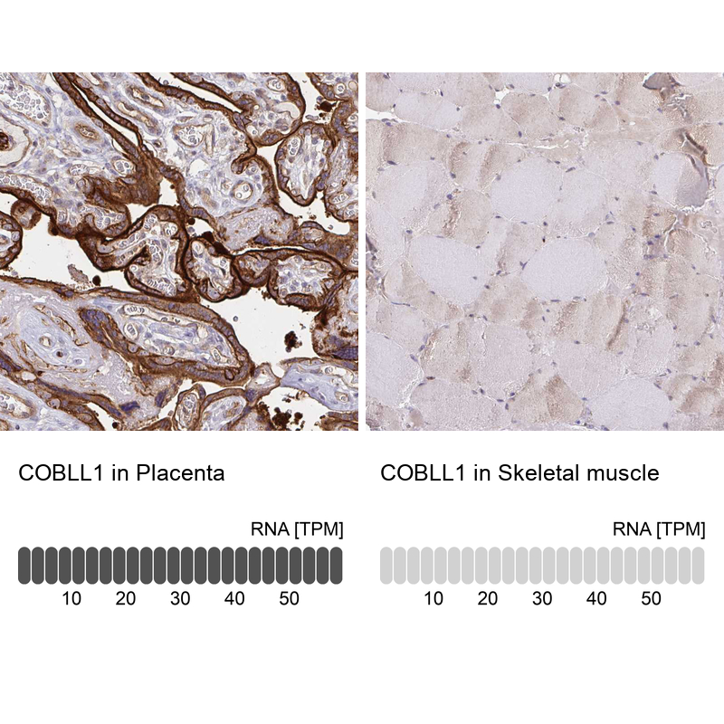 Anti-COBLL1 Antibody