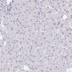Immunohistochemical staining of human liver shows no positivity in hepatocytes as expected.