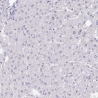 Immunohistochemical staining of human liver shows no positivity in hepatocytes as expected.