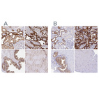 Immunohistochemical staining of human kidney, placenta, prostate and skeletal muscle using Anti-COBLL1 antibody HPA053344 (A) shows similar protein distribution across tissues to independent antibody HPA044933 (B).