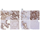 Immunohistochemical staining of human kidney, placenta, prostate and skeletal muscle using Anti-COBLL1 antibody HPA053344 (A) shows similar protein distribution across tissues to independent antibody HPA044933 (B).