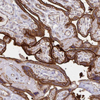 Immunohistochemical staining of human placenta shows strong membranous positivity in trophoblastic cells.