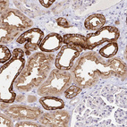 Immunohistochemical staining of human kidney shows strong membranous positivity in cells in distal tubules.
