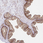 Immunohistochemical staining of human prostate shows strong membranous positivity in glandular cells.
