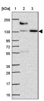 Lane 1: Marker [kDa] 250, 130, 95, 72, 55, 36, 28, 17, 10_br/_Lane 2: Human cell line RT-4_br/_Lane 3: Human cell line U-251 MG