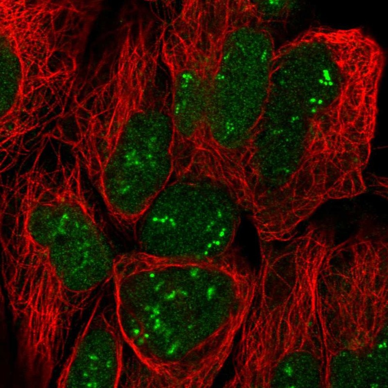 Anti-TRO Antibody
